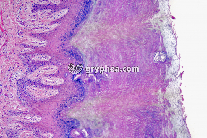 Peau plante du pied CT x25 - gryphea.org